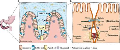 The Role of Leaky Gut in Functional Dyspepsia